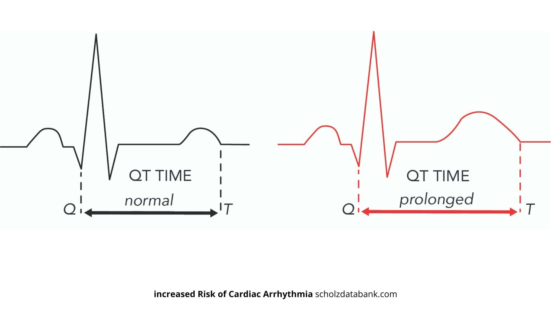 Roughly 10% of Drugs may contribute to increased Risk of Cardiac Arrhythmia due to QT Prolongation